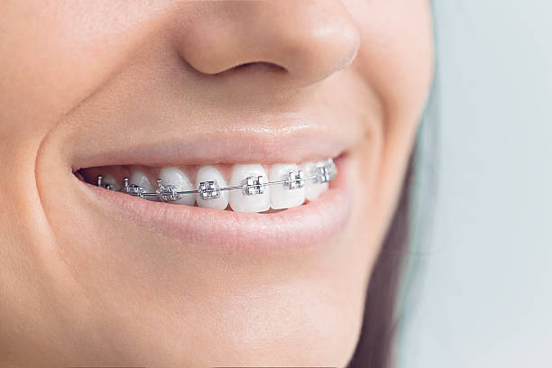 Best Dental Fillings (Composite and Amalgam)  in Farmington, UT